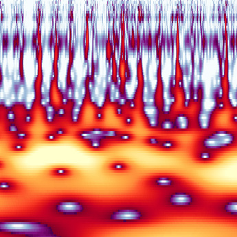 twenty-six day rhythm in epilepsy shown in a spectrogram calculated at the e-Lab, lead by Maxime Baud at the department of Neurology